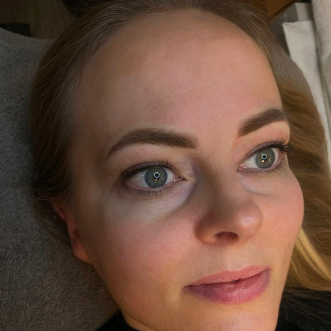 Vippefortætning øvre & nedre